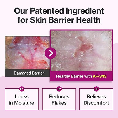 Doctor By Cat Silk Derma Lickable Feline Skin and Coat Supplement - Dandruff Treatment & Itchy Skin Relief Allergy Support for a Glossy Coat Immune Boosting Formula - 30 Individual Treat Tubes